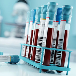 pet blood analyses